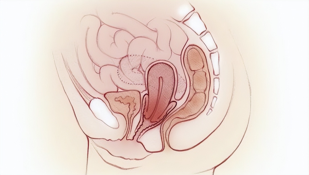 日本妇科病为什么少,日本女性妇科病