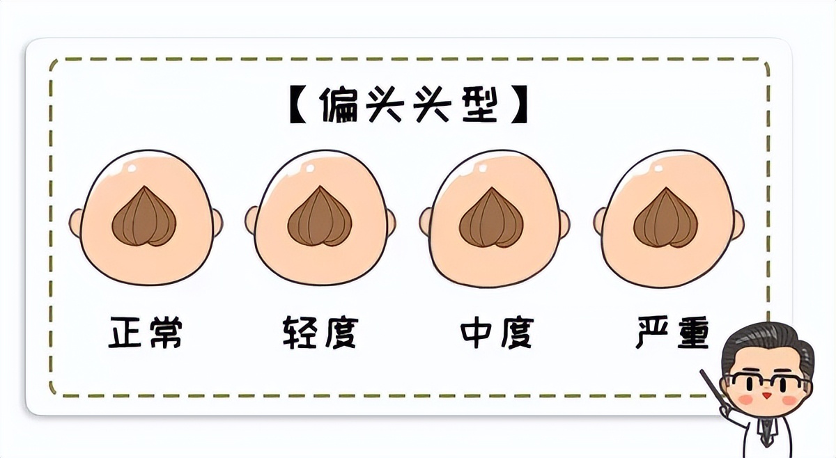 小宝宝总是偏头睡6个月,如何防止宝宝睡偏头及补救方法