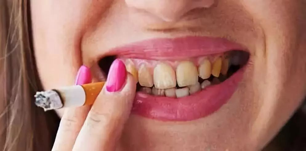 天生牙齿黄能洗白吗,牙齿天生黄是什么原因引起的