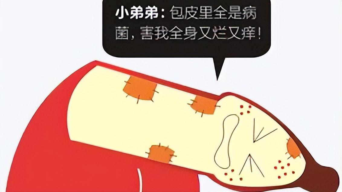 20多岁包皮一定要割吗,40岁了包皮还有必要割吗