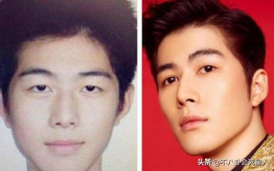 对双眼皮“下手”的明星：浮肿、宽大、失败返工，一个比一个狠