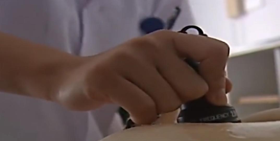 上海农妇怀胎四年,上海农妇怀胎四年未生全集