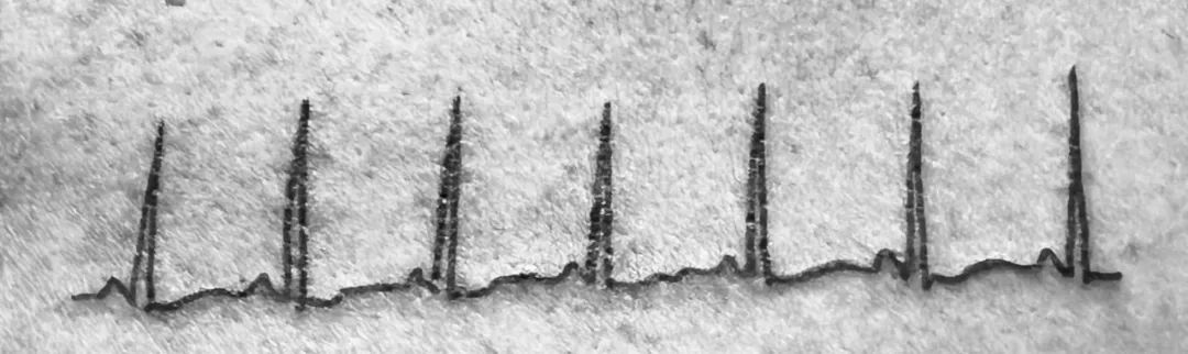 田纳西上千人送行,美国小镇千人送别湖北女孩