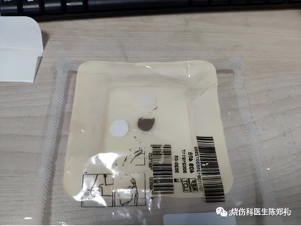 慢性创面患者的敷料运用及选择,创面换药敷料的选择