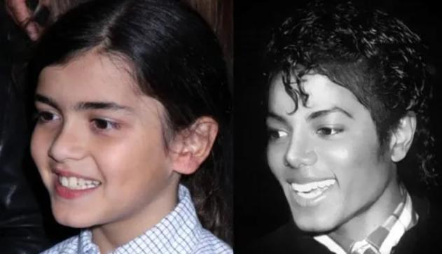 杰克逊大儿子遗传病,迈克尔杰克逊去世得了什么疾病