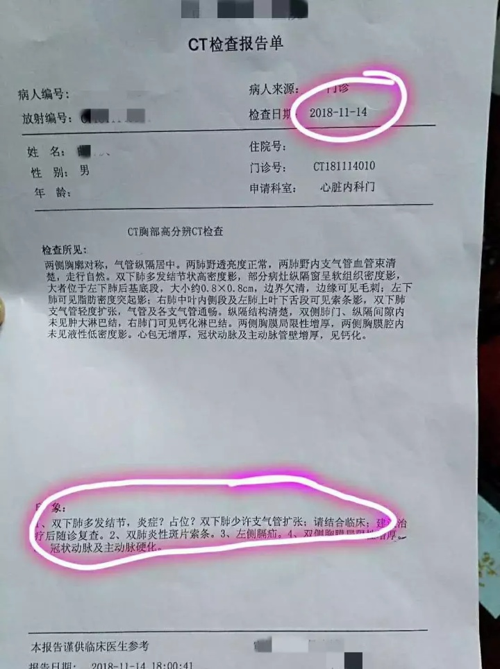 磨玻璃结节ct征象,2.0磨玻璃结节需要手术吗