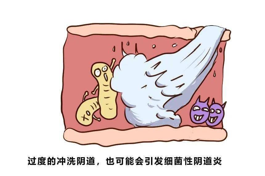 内裤上有分泌物什么原因,为什么内裤总是有分泌物