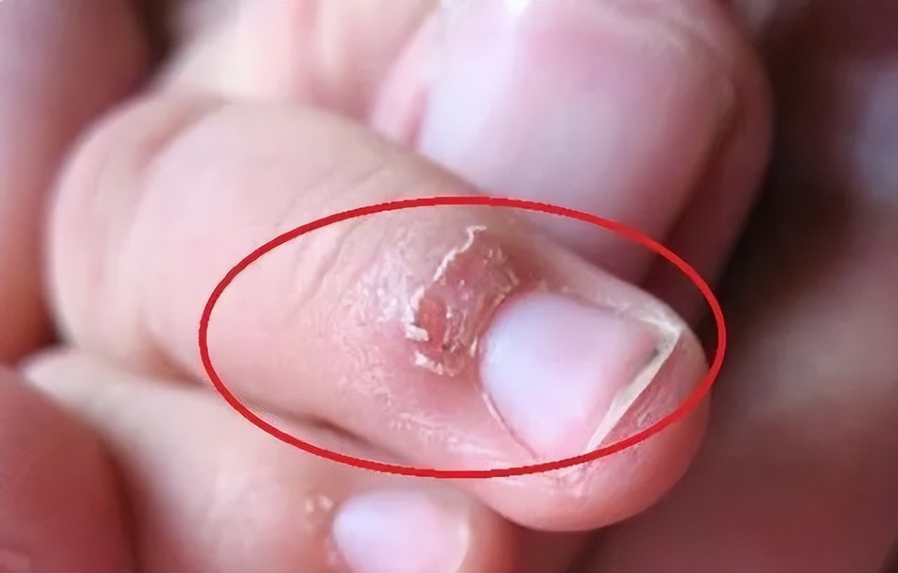 孩子缺锌怎么办吃什么补得最快,孩子缺锌长得慢补锌就会长高吗