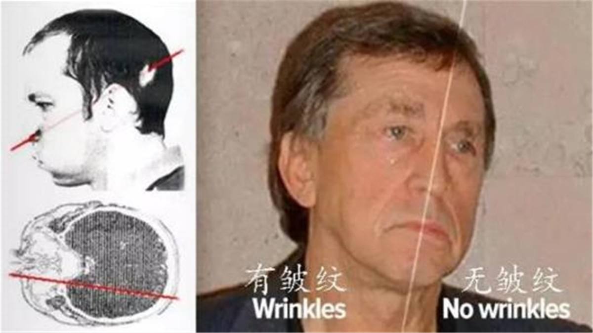 把头伸进粒子加速器,把头伸进粒子加速器怎么样了