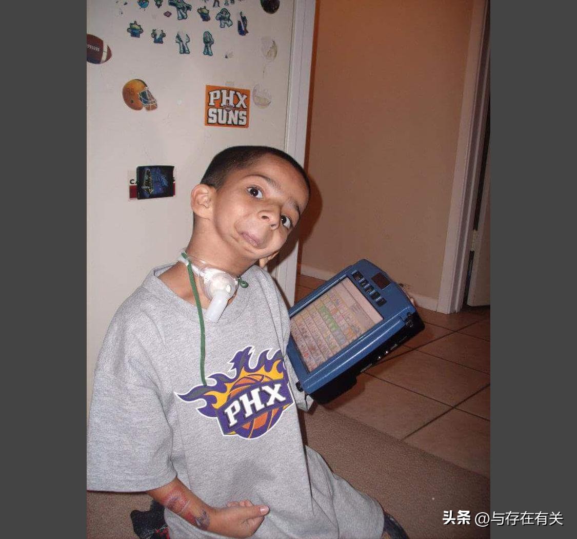 没有下巴的男人怎么改善,没有下巴的男人命运怎么样