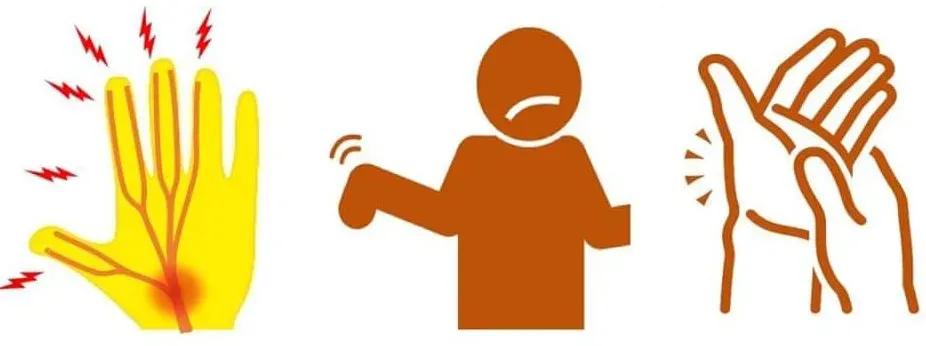 手麻腕管综合征,手指麻是腕管炎吗