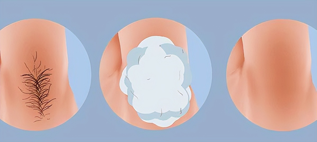 有些人为什么没有毛发,为什么有的人没有什么汗毛