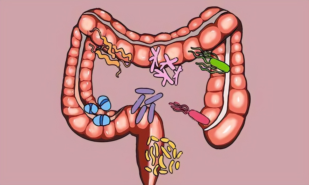 经常放屁是肠道出问题了吗,经常放屁是肛肠有毛病吗