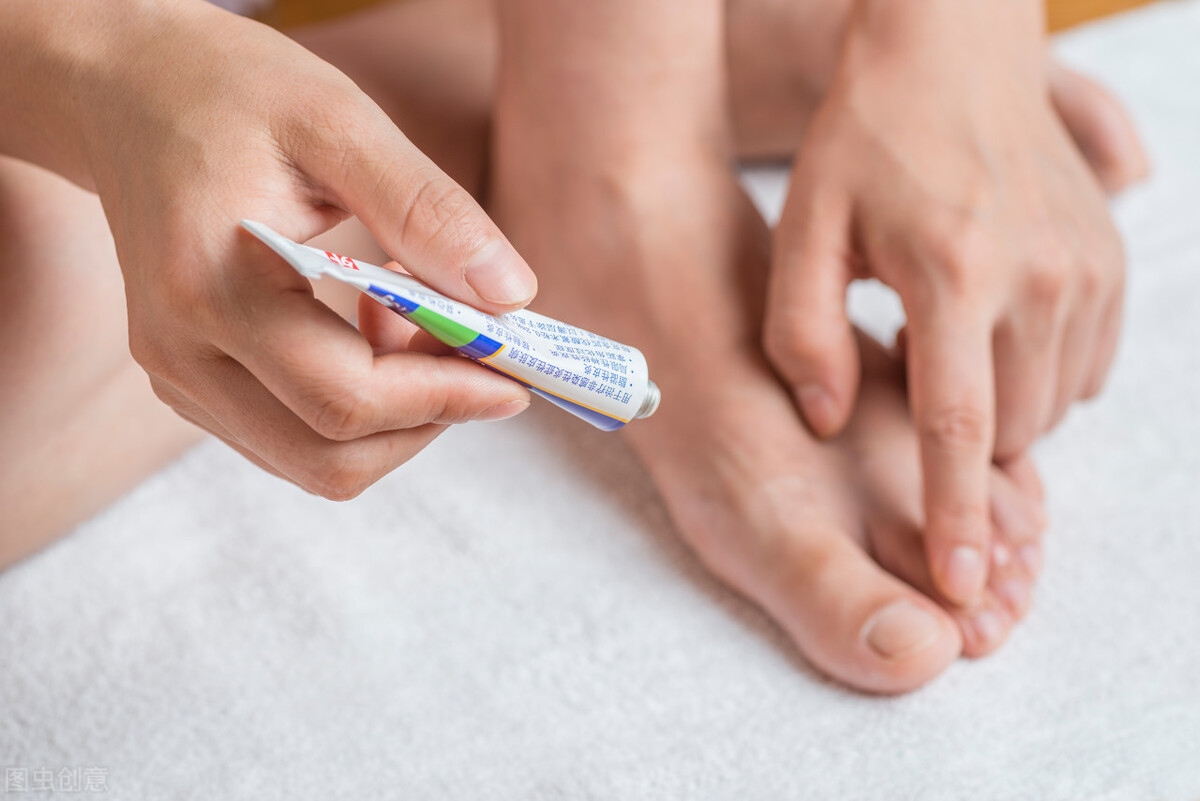 真菌手足癣用什么药最好,真菌感染手足癣什么药最好