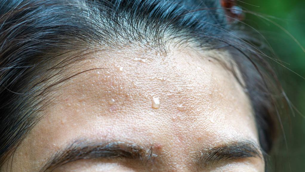 湿疹痱子傻傻分不清,湿疹和痱子我们应该怎么区分