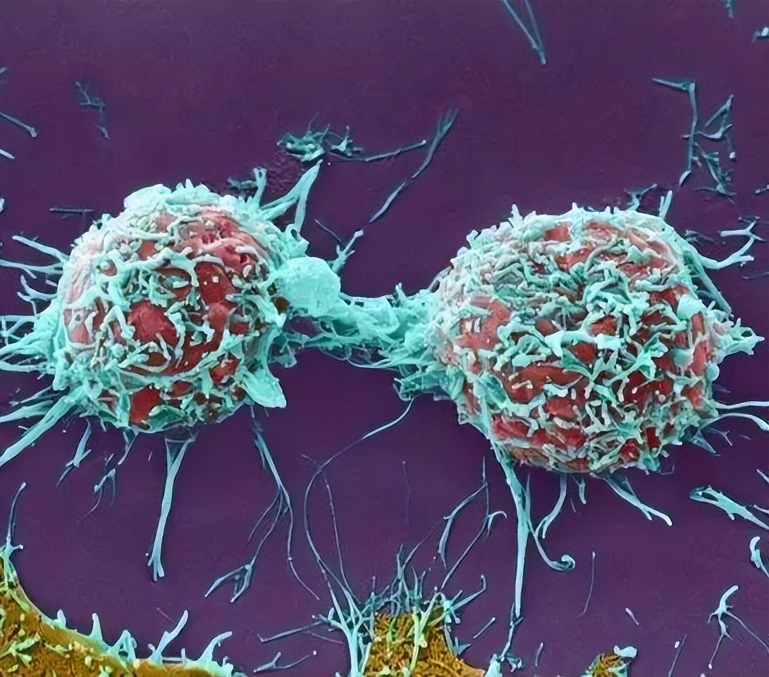 如果发现病不治能活多久,如果发现患癌不治疗的话能挺多久