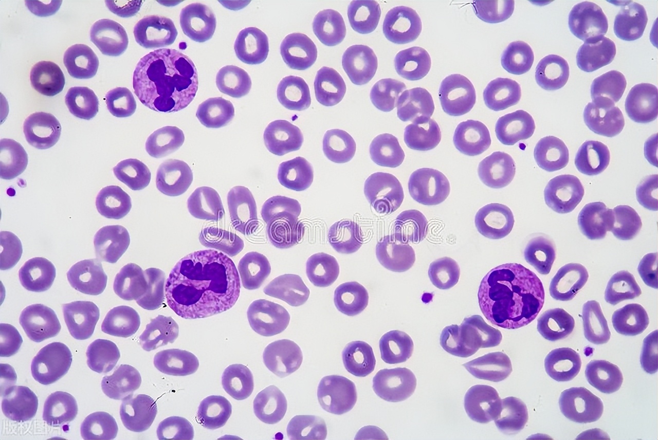 血小板减少会有哪些症状呢,免疫性血小板减少症症状