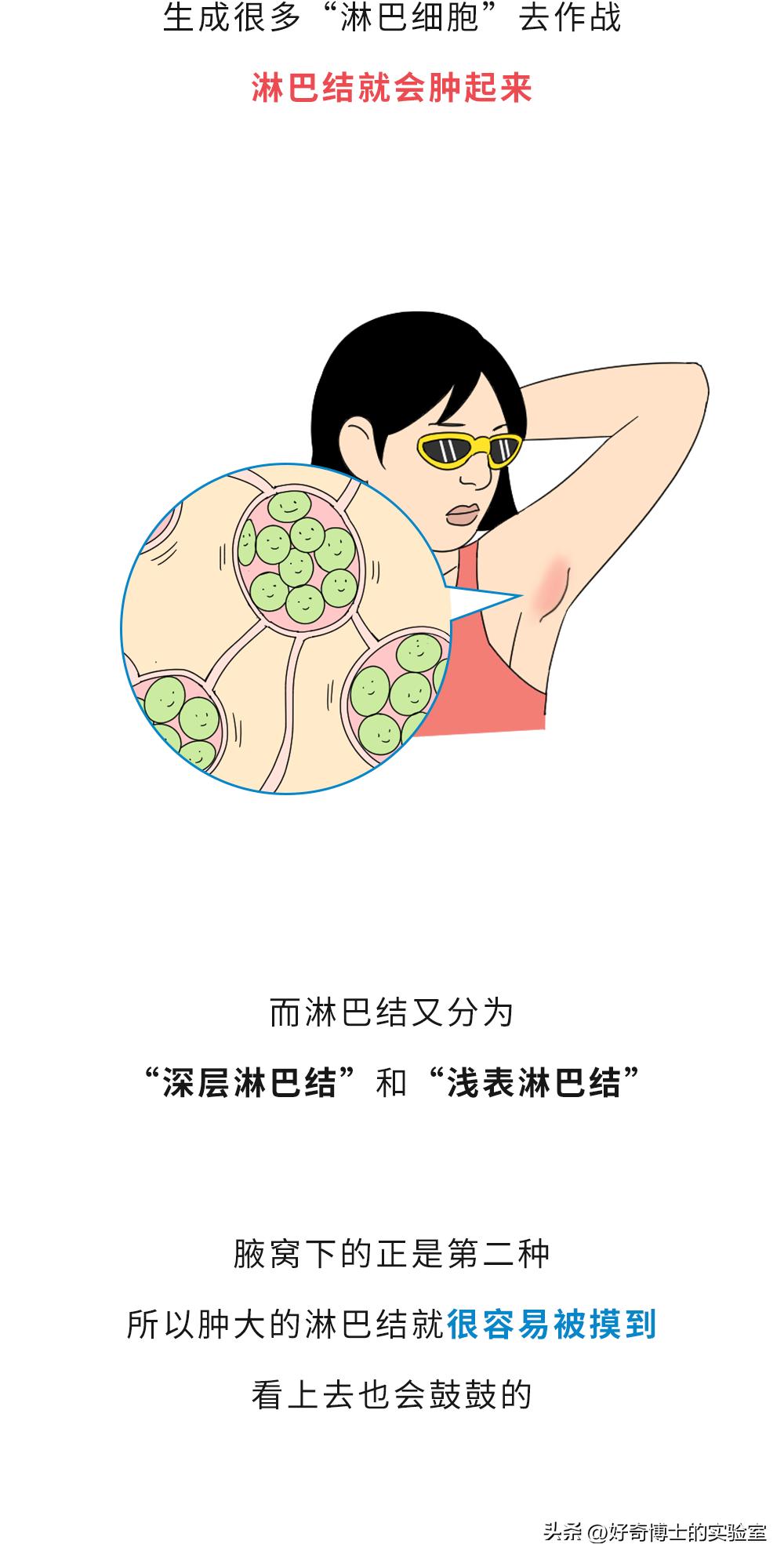 为什么有的人腋窝深,每个人腋窝下都有大凸起吗