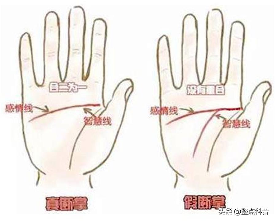 民间断掌纹说法,断掌纹与先天疾病