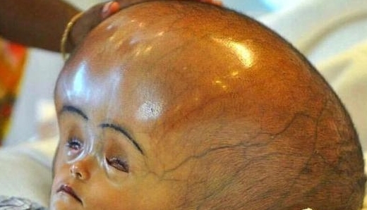 家庭教育对婴儿大脑的影响,宝宝摔倒后脑勺着地会影响智力吗