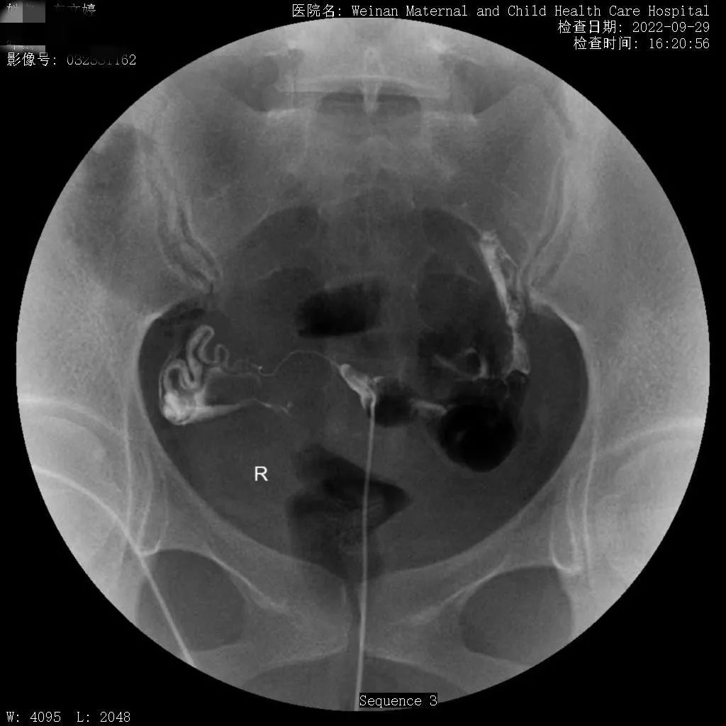 致敬公司的摄影师,美女致敬摄影师视频