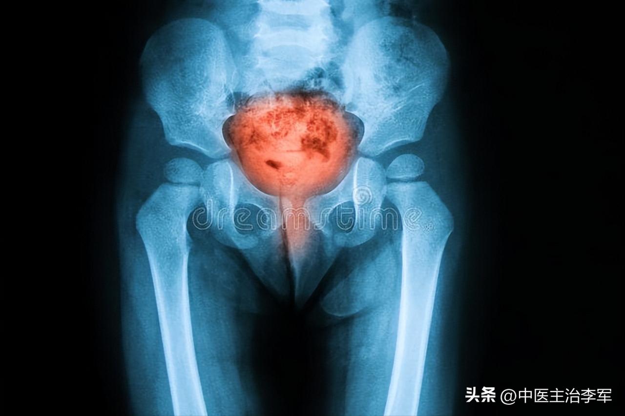 龙胆泻肝丸有清热解毒的效果吗,龙胆泻肝丸几盒能治好肝火