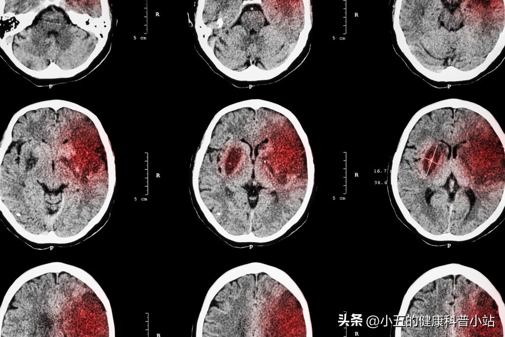 增强大脑活动的药物,增强大脑功能的药物