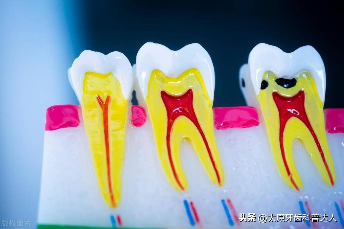 牙龈出血牙齿松动的原因是什么,牙齿松动牙缝越来越大是什么原因