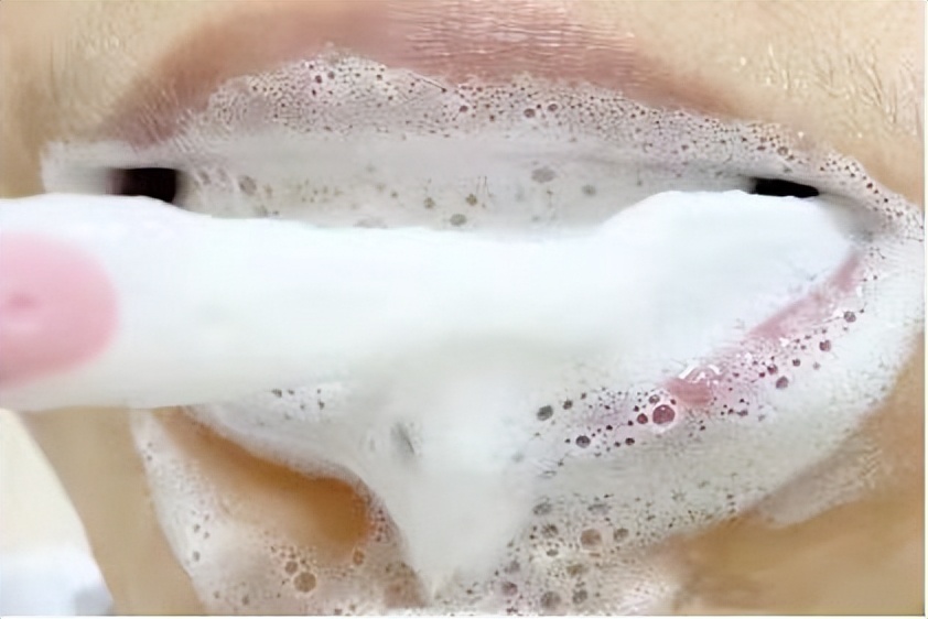 戴牙套会把牙齿戴黄?教你一个小妙招,轻松美白牙齿很简单!