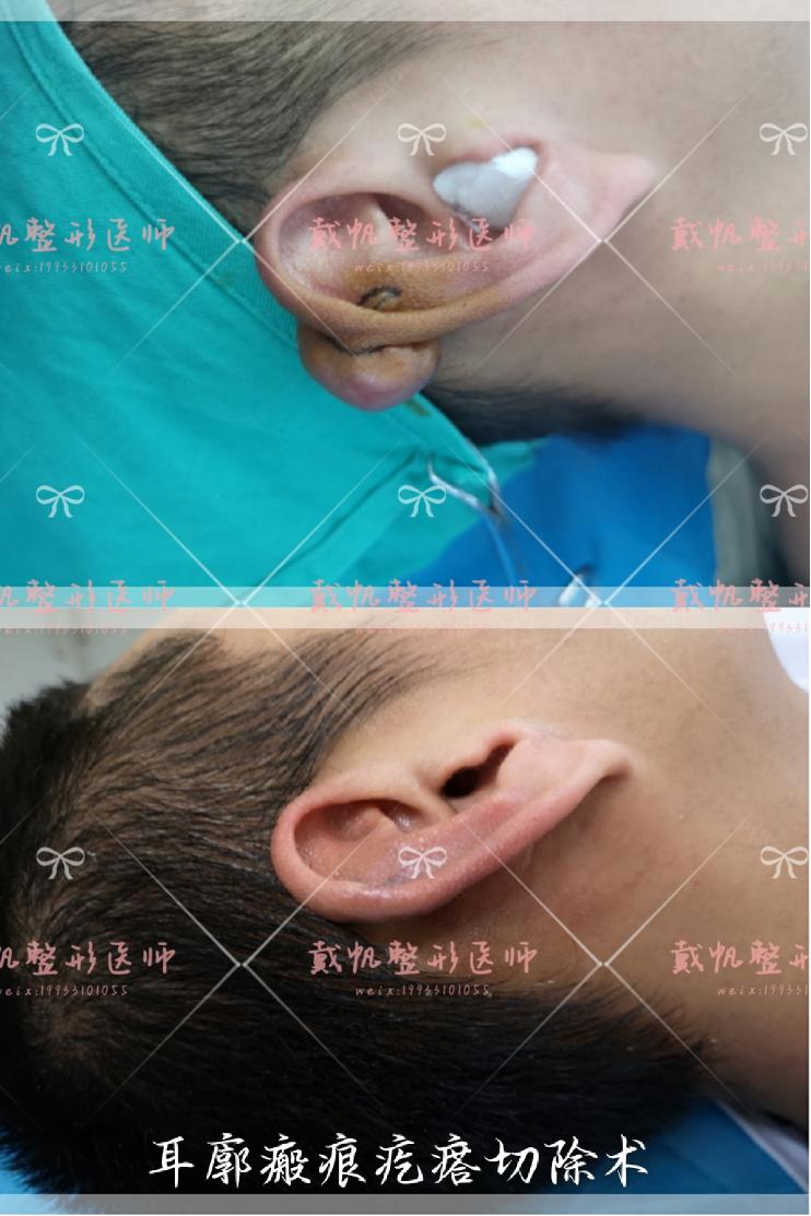 医疗美容变美秘诀,美容科医生教你悄悄变美