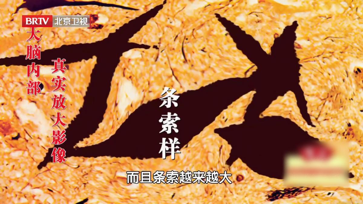 防止老年斑吃什么食物最好,预防大脑衰老的食物