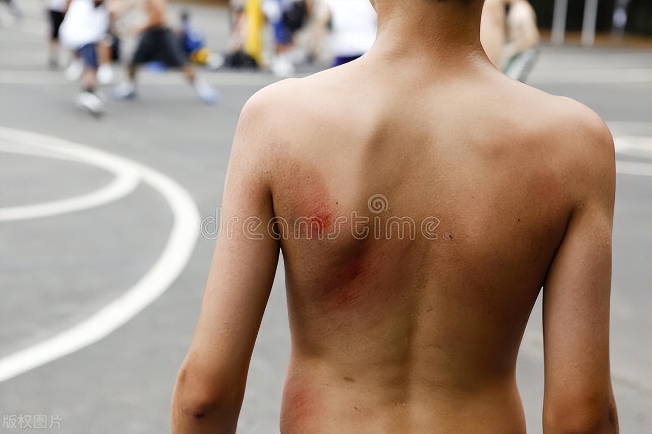 脖子上的小肉球千万别去用手拽,脖颈上的小肉球怎么办