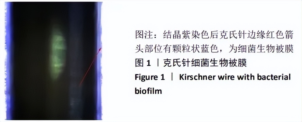 遵义医科大学附属医院骨科简介,遵义医科大学附属医院关节科简介