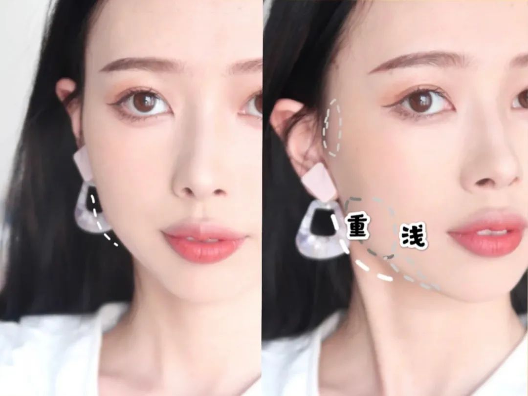 脸型不对称的女孩咋办,脸型不好看怎么整容