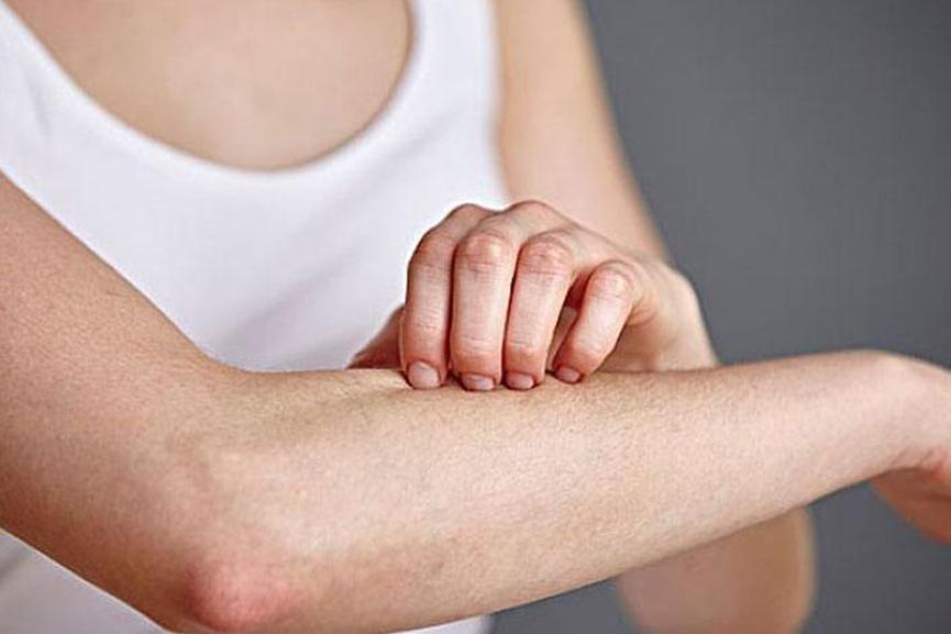 入秋皮肤痒起包怎么办,地肤子白鲜皮治皮肤瘙痒有绝招