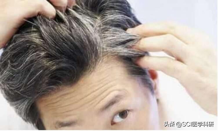 为什么年纪轻轻白发越白越多,45岁80%的头发白了是什么原因