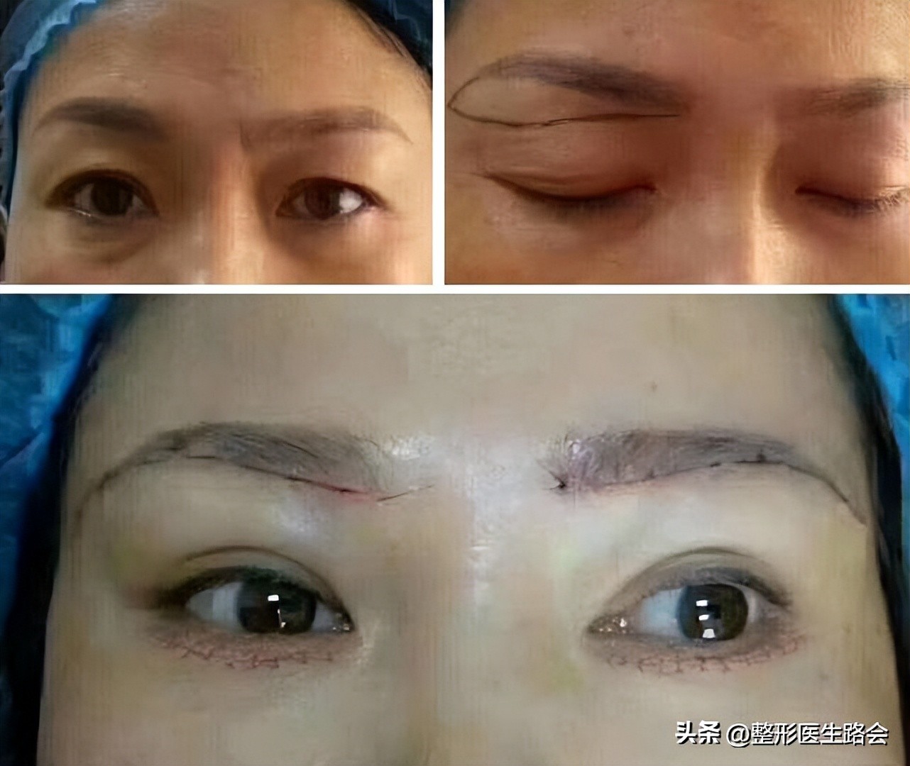 面部暗沉无光泽显老怎么改善,皮肤暗沉皱纹显老