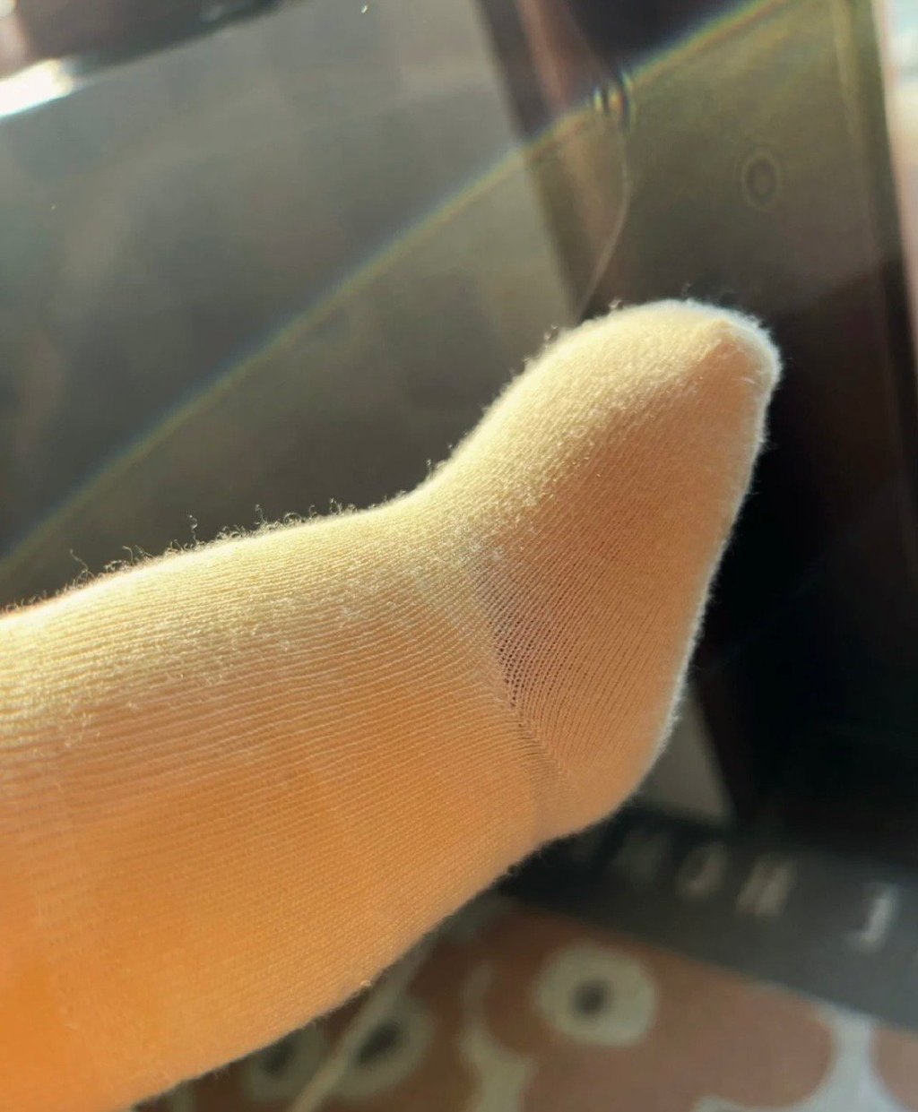 婴儿没后脚跟会怎样,啥意思原来婴儿是没有后脚跟的