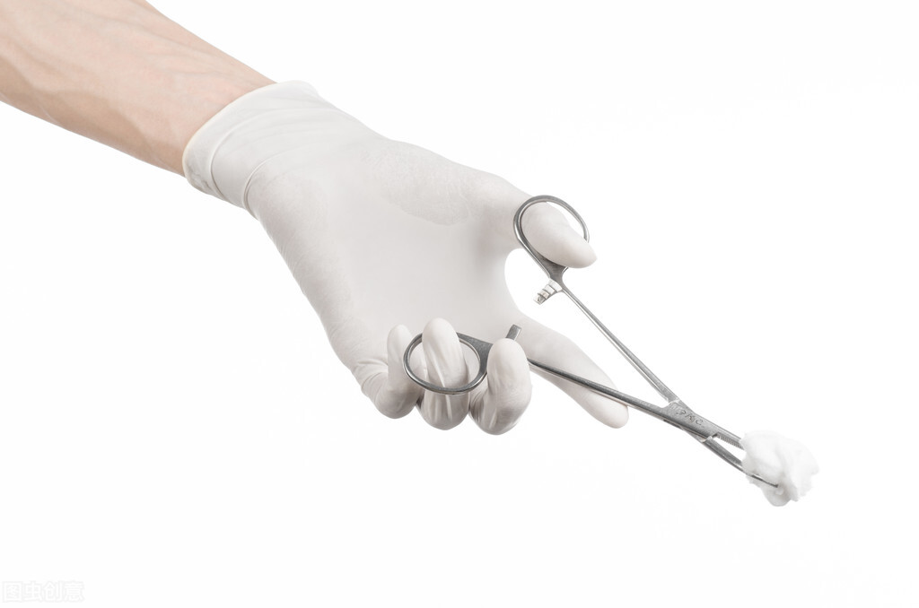 环切吻合器割完拆纱布后注意事项,包皮环切吻合器钉子多久脱落