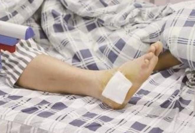 在野外遇到毒蛇怎么办,在野外遇到蟒蛇该怎么办