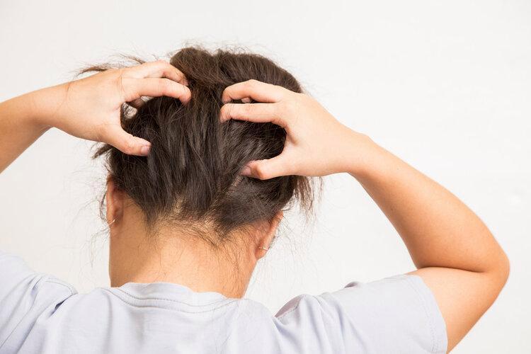 头皮总是长疙瘩脓包怎么回事,头皮总是长疙瘩或脓包是什么原因