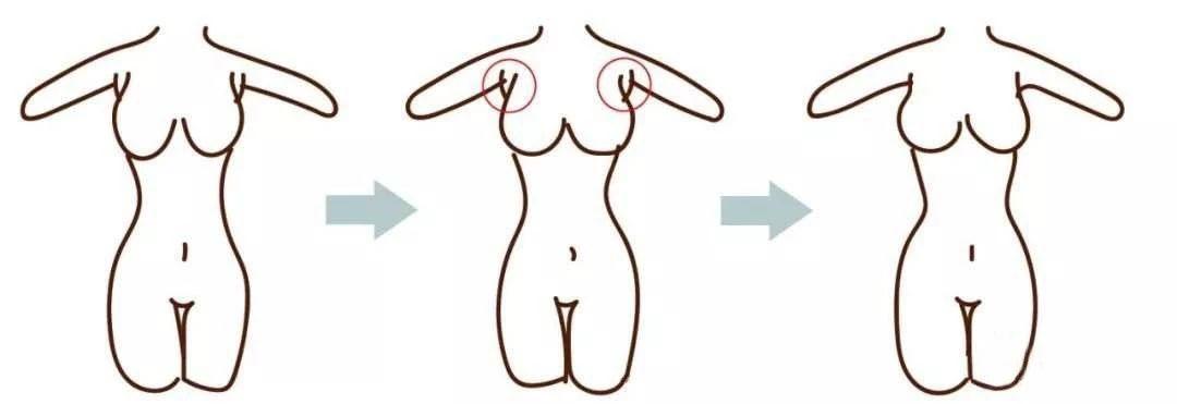 男人腋下赘肉和副乳的区别有哪些,腋下赘肉和副乳怎么分辨