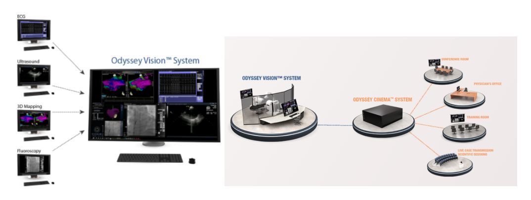 心脏射频消融机器,射频消融导管磁定位型
