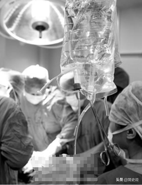 安徽女子割肝救丈夫,河南44岁农妇割肝救夫