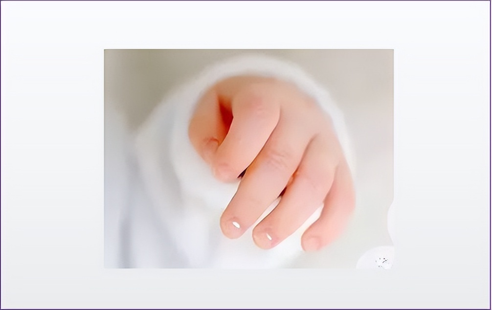 宝宝指甲有白斑是肚子有虫吗,一周半宝宝指甲上有白点怎么回事