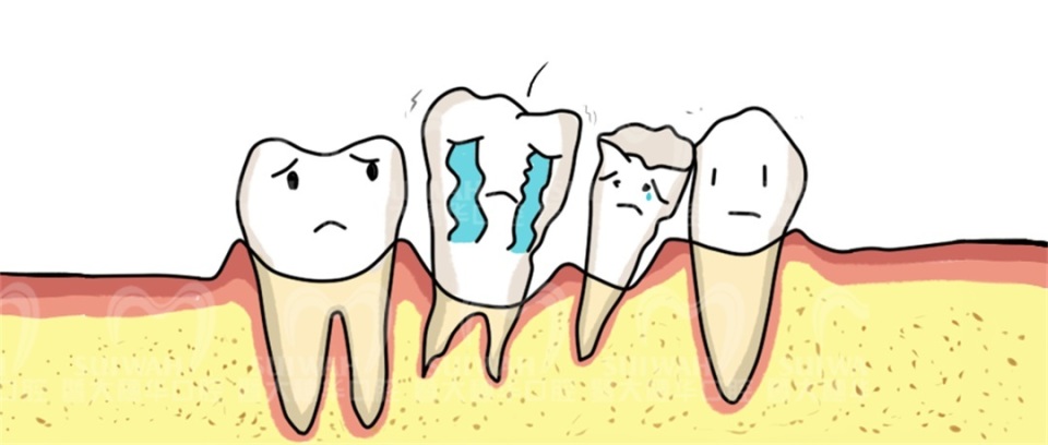 暨大穗华口腔种植一颗牙多少钱,暨大穗华口腔1980种牙靠谱吗