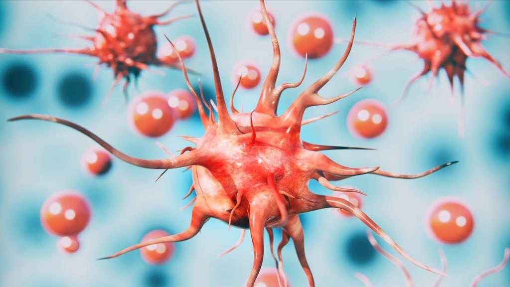 肉瘤容易误诊吗,肉瘤是不治之症吗