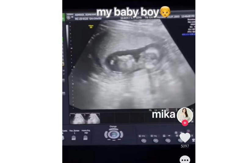 去泰国做变性手术的网红是谁,28岁网红去泰国做变性