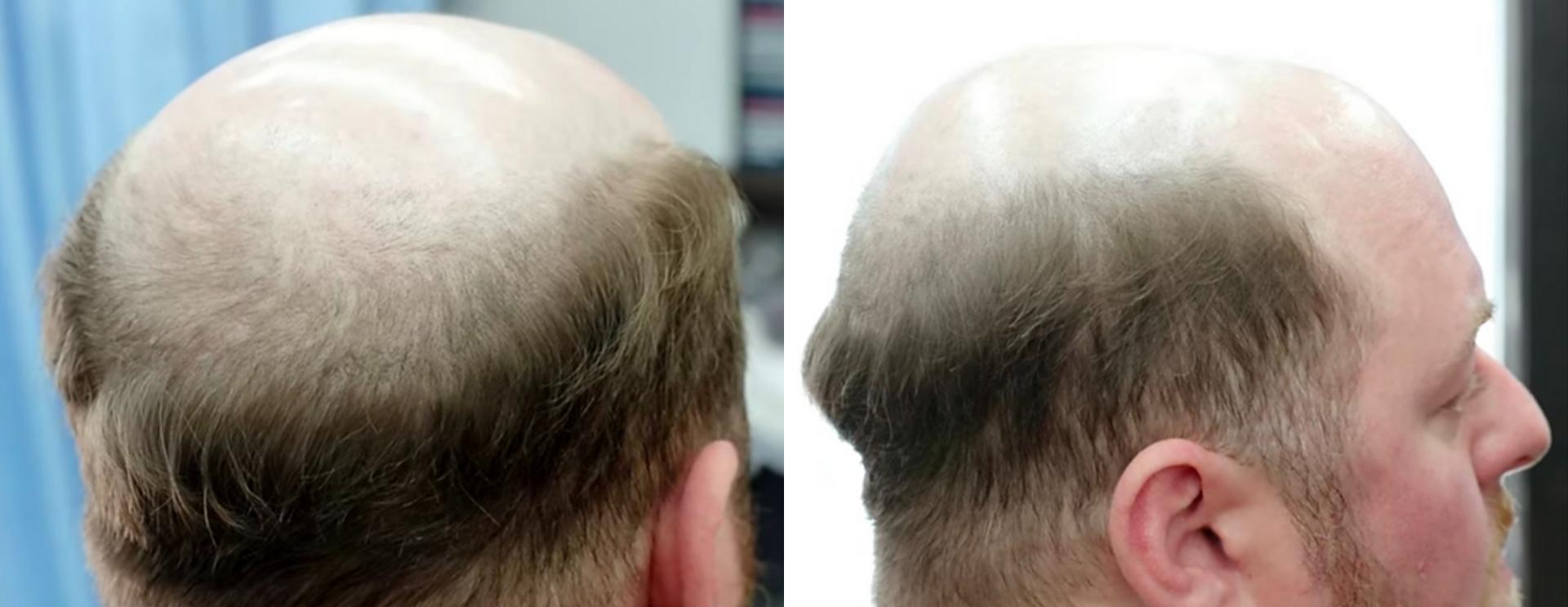 戴假发用的胶怎么清洗,假发上的粘胶怎么清理