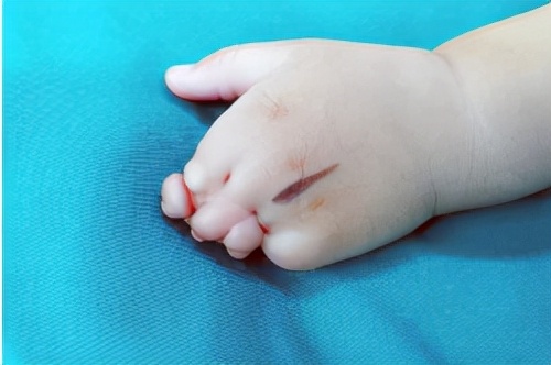 抗击疫情硬核技术,抗击疫情中的尖端技术